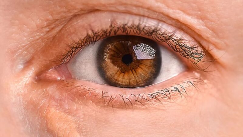 بقع العين الصفراء: مؤشر محتمل لمخاطر قلبية ودماغية